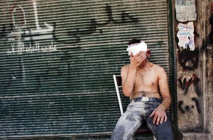 Syrian man wounded by shelling sits on a chair outside a closed shop in the Al-Muasalat area in Aleppo  AFP PHOTO/ACHILLEAS ZAVALLIS 