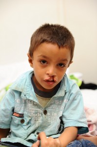 Before the surgery on 17 September Ahmed Ibrahim 