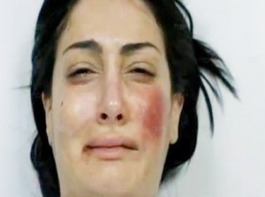 A Snapshot of Farida’s face after being beaten up by her husband Monir on “Maa Sabq el-Israr” soap opera of Ramadan 2012  (Photo from MBC.net ) 