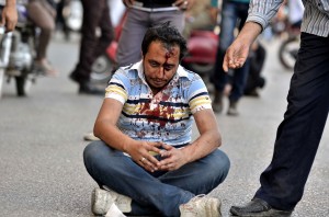 An Injured protester sits on the road while protesters throw stones during clashes between the Muslim Brotherhood movement's opponents and supporters on April 19, 2013 in central Cairo.  (AFP Photo)